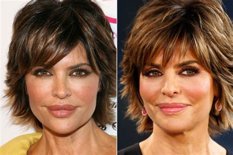 Lisa Rinna's Plastic Surgery Is Even More Visible Without Makeup - DemotiX