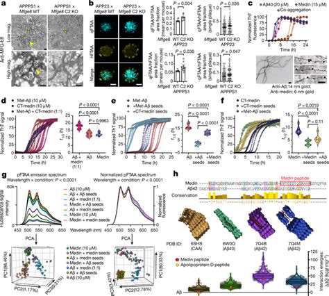 Medin Interacts Directly With Amyloid Promoting Its Aggregation A