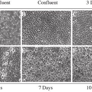 Adipocyte Differentiation In Vitro Phase Contrast Photomicrograph Of