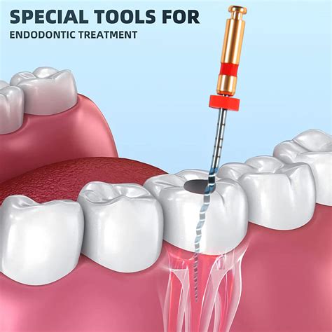 Buy E Mm Dental Endodontic Engine Use Niti Super Rotary File Root