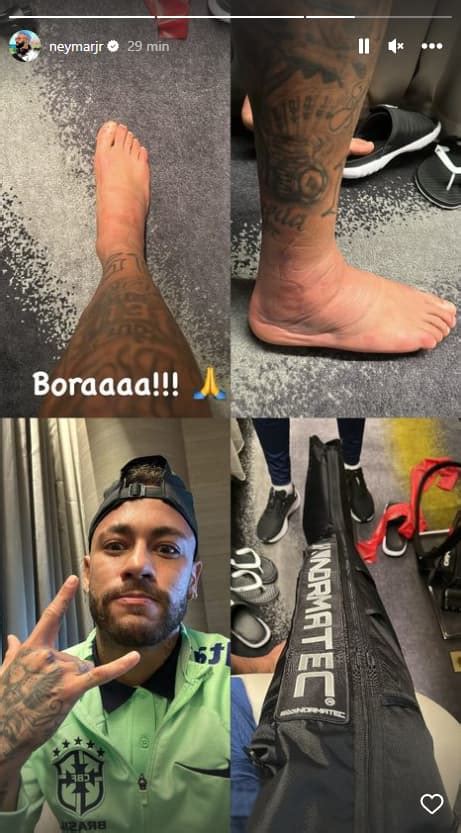 Neymar Perlihatkan Cedera Pergelangan Kaki Kondisinya Diragukan