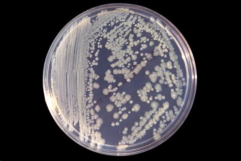 Klebsiella antibiotic coverage