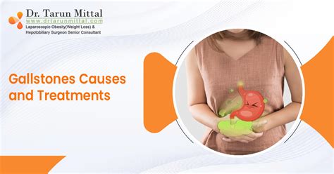 Gallstones Causes And Treatments Dr Tarun Mittal