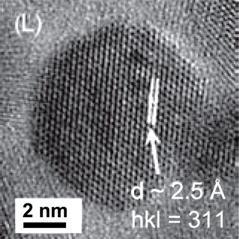 Transmission Electron Microscopy Tem Images Clearly Showing A