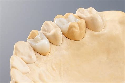 Fresadora Dental Cad Cam