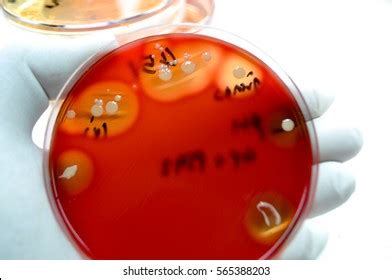 White Bacteria Beta Hemolysis Colonies On Stock Photo 565388203 ...