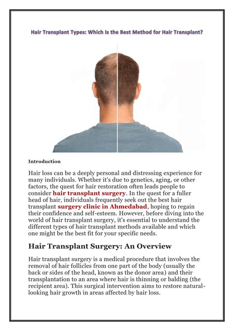 Ppt Hair Transplant Types Which Is The Best Method For Hair Transplant Powerpoint