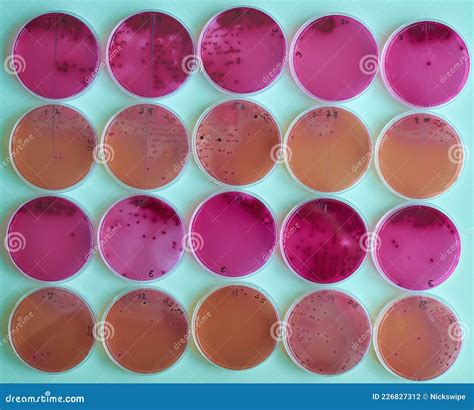 Agar Plates With Bacteria Colonies In Various Petri Dish Stock Photo