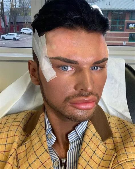 Yorkshires Real Life Ken Doll Slams New Barbie Movie As Unrealistic