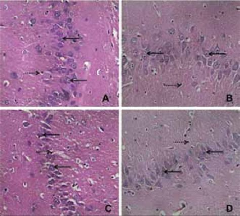 Photomicrographs Of CA3 Region Of The Hippocampus H E 400 Observe