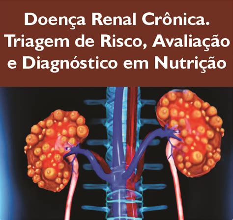 Doença Renal Crônica Triagem de Risco Avaliação e Diagnóstico em Nutrição