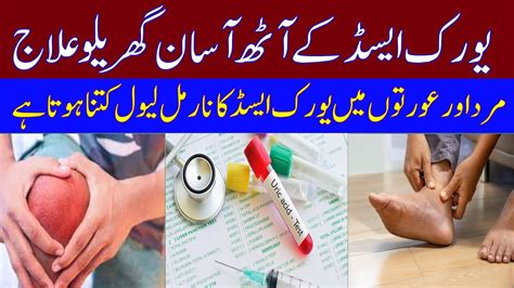 Uric Acid Home Treatment In Urdu Uric Asid Ka Ilaj How To Reduce