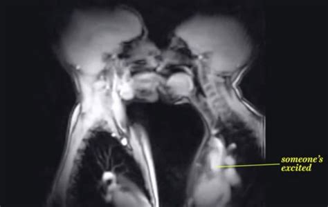性交的mri是怎樣？英國研究拍攝真實情侶做愛動態透視 Ettoday國際新聞 Ettoday新聞雲