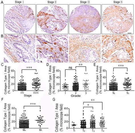 Correlation Analysis Between Collagen Type I Expression And