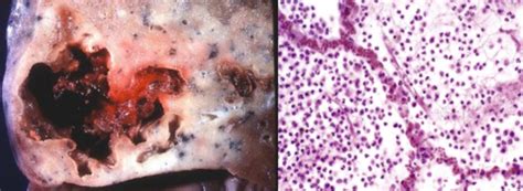 Mechanisms Of Microbial Pathogenesis Ryznar Flashcards Quizlet