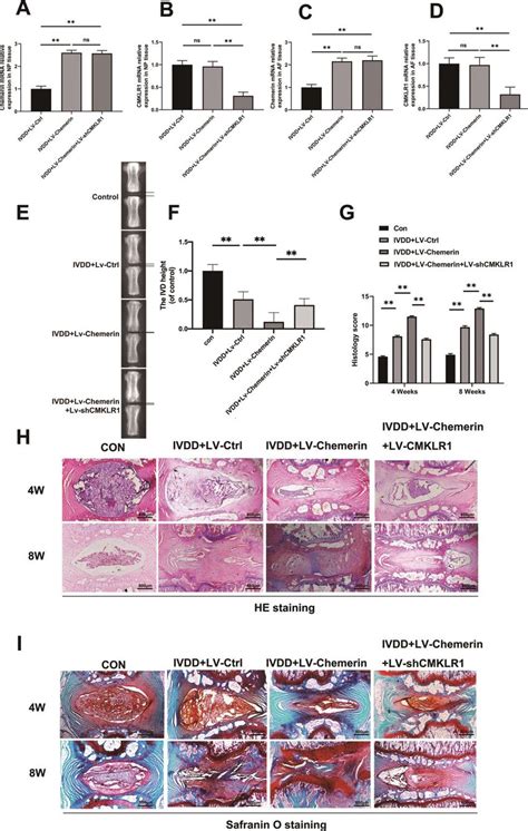 Chemerin Aggravates The Progression Of Ivdd In Rat S Annulus Needle