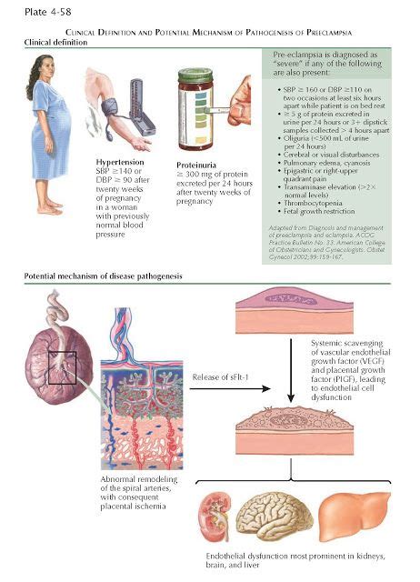 Preeclampsia Artofit