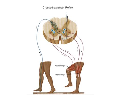 crossed extensor reflex Quiz