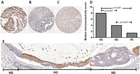 The Expression Of Adhfe1 According To The Differentiation Status In