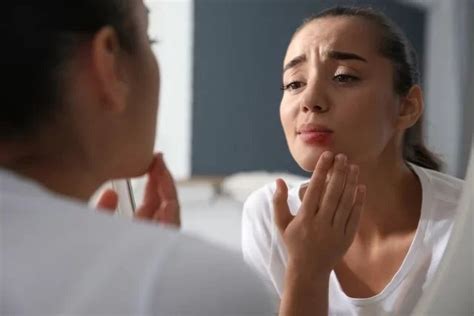 Labios Hinchados 10 Causas Y Qué Hacer Tua Saúde