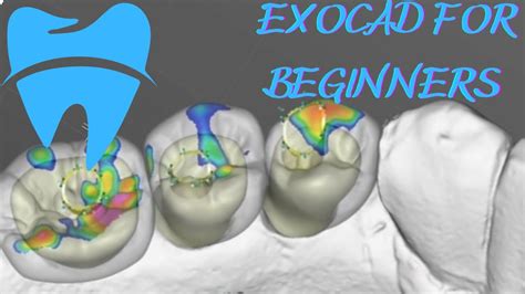 Fastest Exocad Video Tutorial Screw Retained Reduced Crowns Youtube