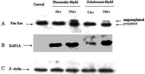 Inhibition Of Ras And Rap Prenylation By Fluvastatin And Zoledronic