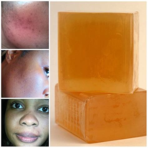 Buy Tumeric Maskturmeric Soap Acneskin Brightening Soap Kojic Acid