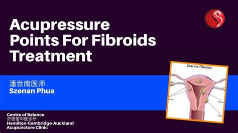 Acupressure Points For Fibroids Treatment Hamilton Cambridge Auckland