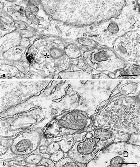 Electron Micrographs Illustrating Immunoperoxidase Labeled 5 HT 1B