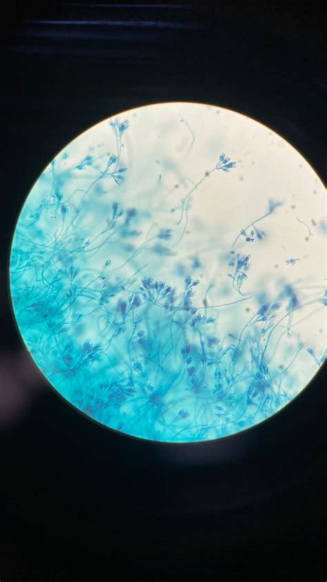 Fungi Under Microscope Health Science Microbiology Science