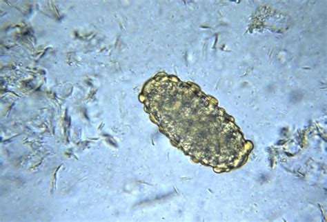 12 Common Intestinal Parasites