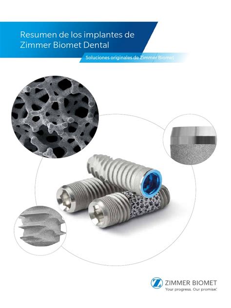 ZB0905ES REV+B Zimmer+Biomet+Dental+Implants+Overview Final SECURED ...