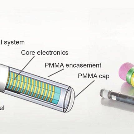 Eversense Ò implantable glucose sensor DXA dexamethasone acetate