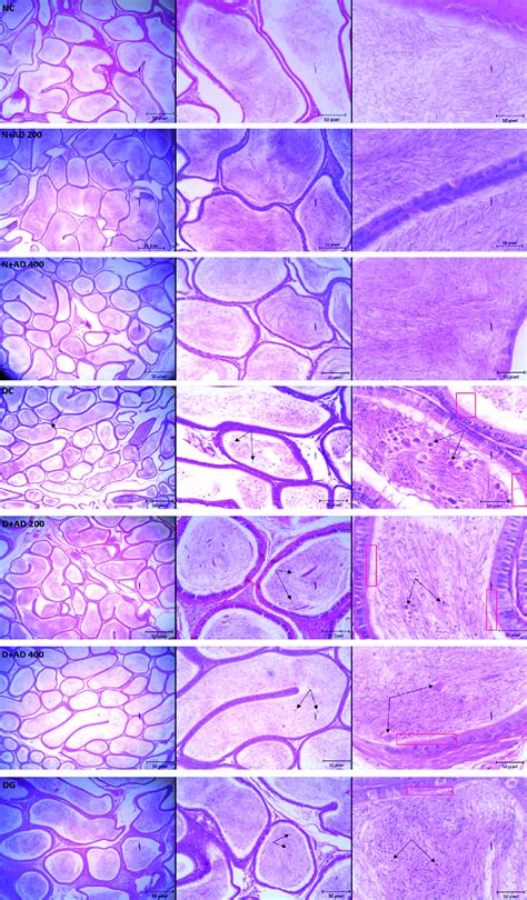 Light Micrographs Of The Testes Of Normal And Diabetic Rats Stained