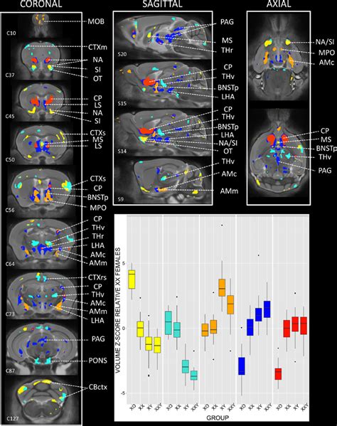 Triangulating The Sexually Dimorphic Brain Through High Resolution Neuroimaging Of Murine Sex