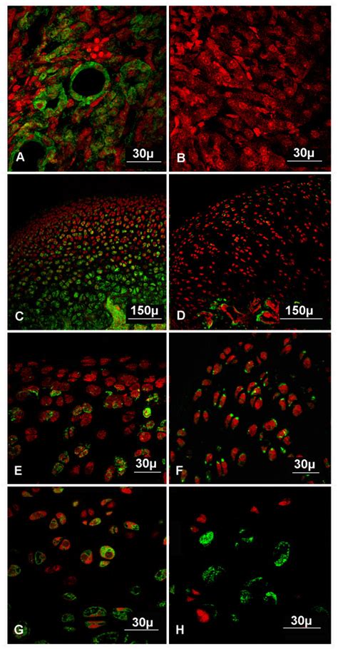 Immunolabeling Of Lxn Protein In Normal Articular And Osteoarthritic