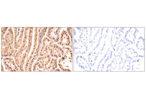 Ubiquitin E K Y Xp Rabbit Mab Bsa And Azide Free Cell Signaling