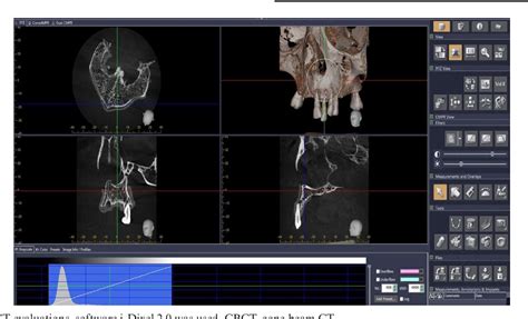 Figure From Comparison Of Cbct With Different Voxel Sizes And