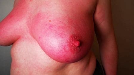 Hard Slapping Tits Real Red Pics XHamster