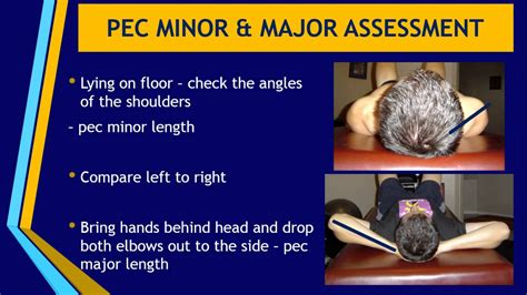 Assessment Of Pectoralis Major And Minor Active Anatomy Youtube