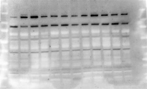 How To Explain Negativewhite Bands On A Western Blot