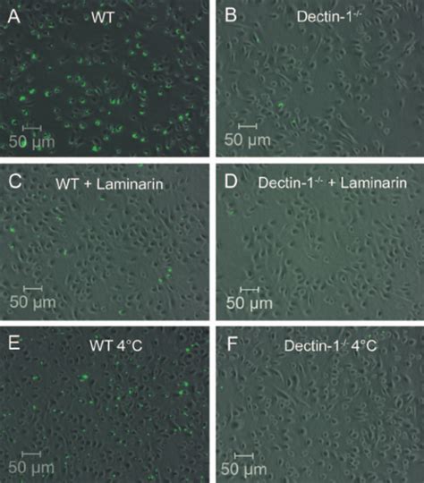 Dectin 1 Dependence Of TNF Production In BMDCs Stimulated By