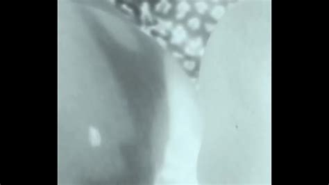 X Ray Anal Search XVIDEOS