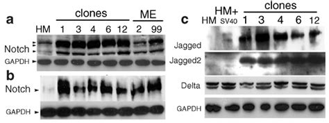 Overexpression Of Notch 1 And Its Ligands In SV40 Transformed HM Clones