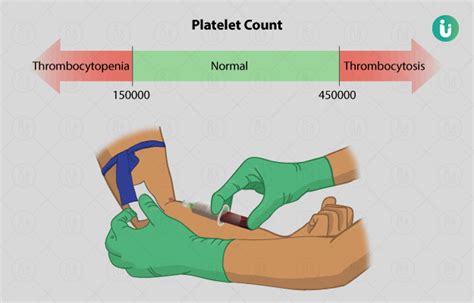 Platelet Count Procedure Purpose Results Normal Range Cost Price