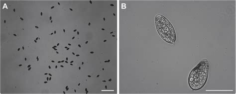 Schistosoma Haematobium Egg Morphology