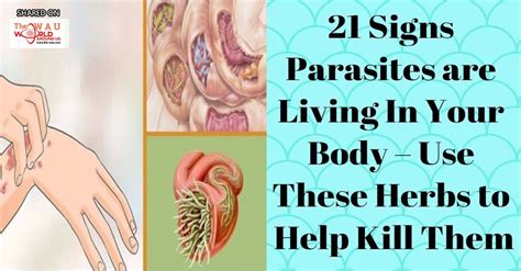 Here 21 Signs Parasites Are Living In Your Body Blog Health Wau