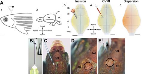 Micromanipulation Of Gene Expression In The Adult Zebrafish Brain Using