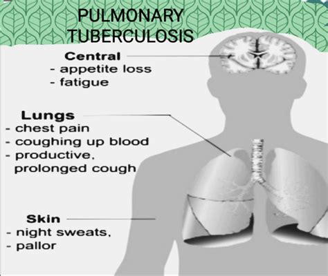 Pulmonary Tuberculosis Tb