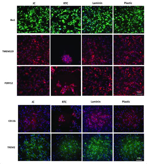 immunocytochemistry staining  typical microglia markers  imgl